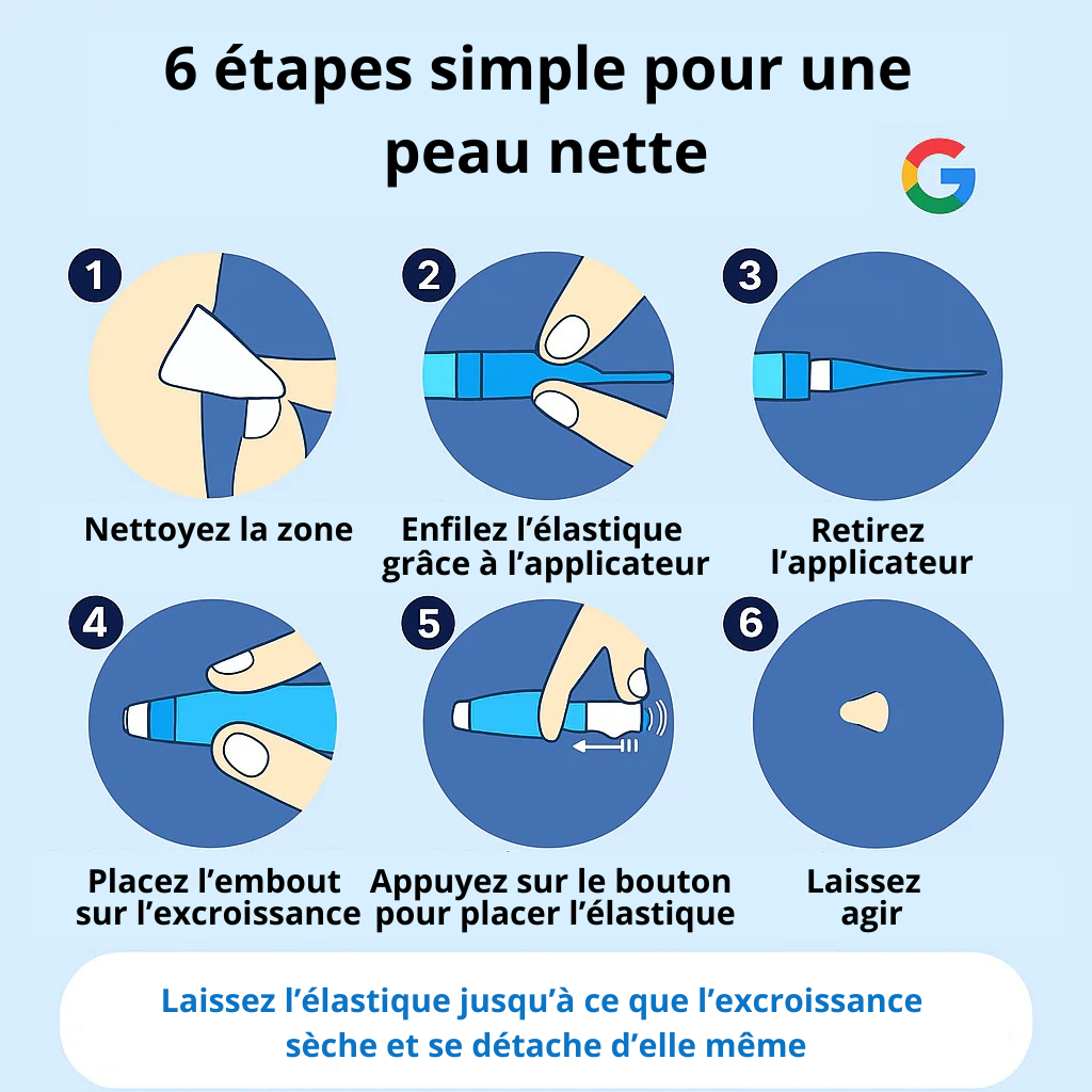 Vora® - Kit anti-excroissances