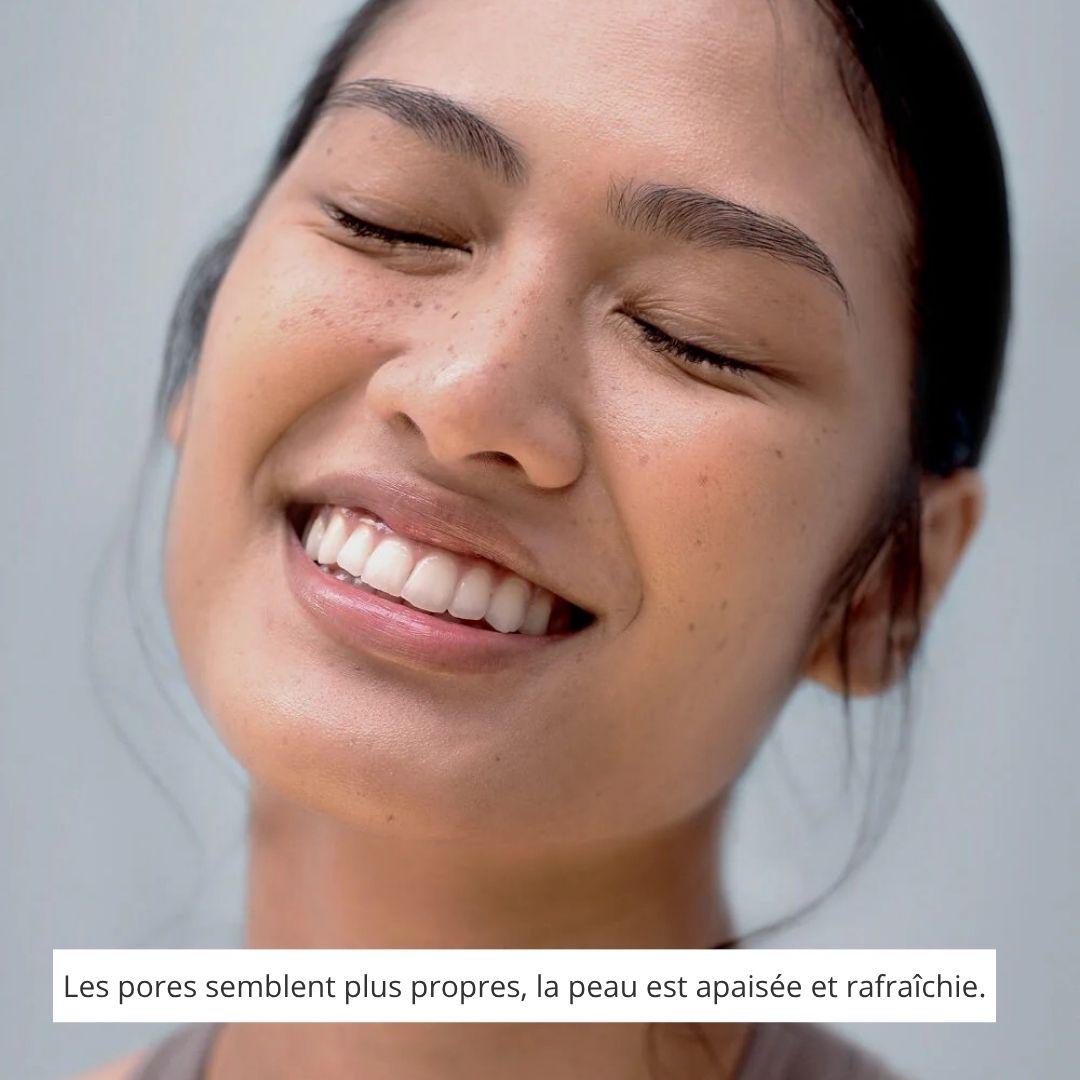 Vue® - Patchs hydrocolloïdes