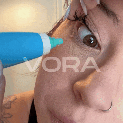 Vora® - Kit anti-excroissances